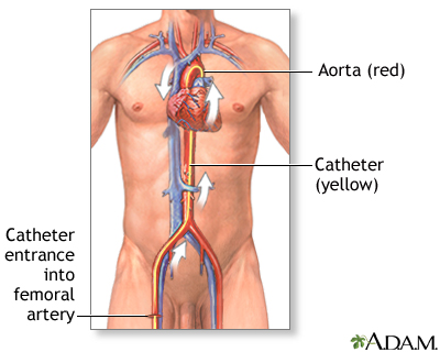 human veins and arteries diagram. human veins and arteries diagram.