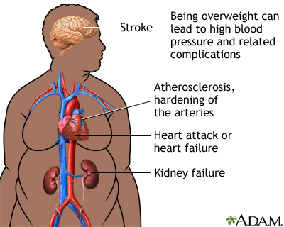 Baby Sleep Problem on Obesity Specialist   Alexian Brothers Health